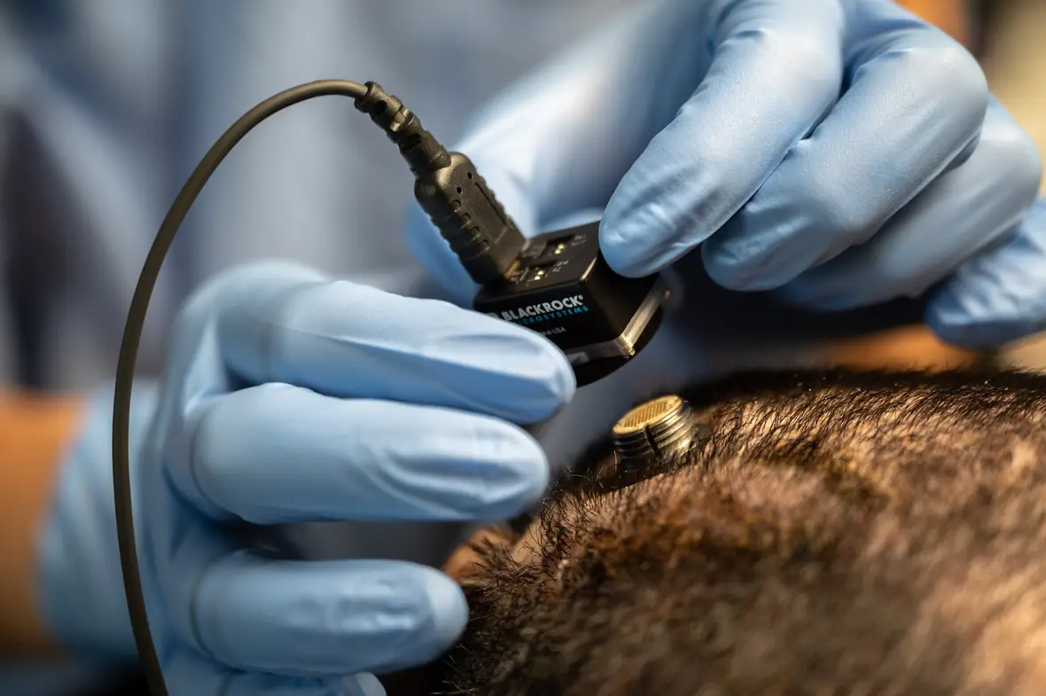 Implantable sensors