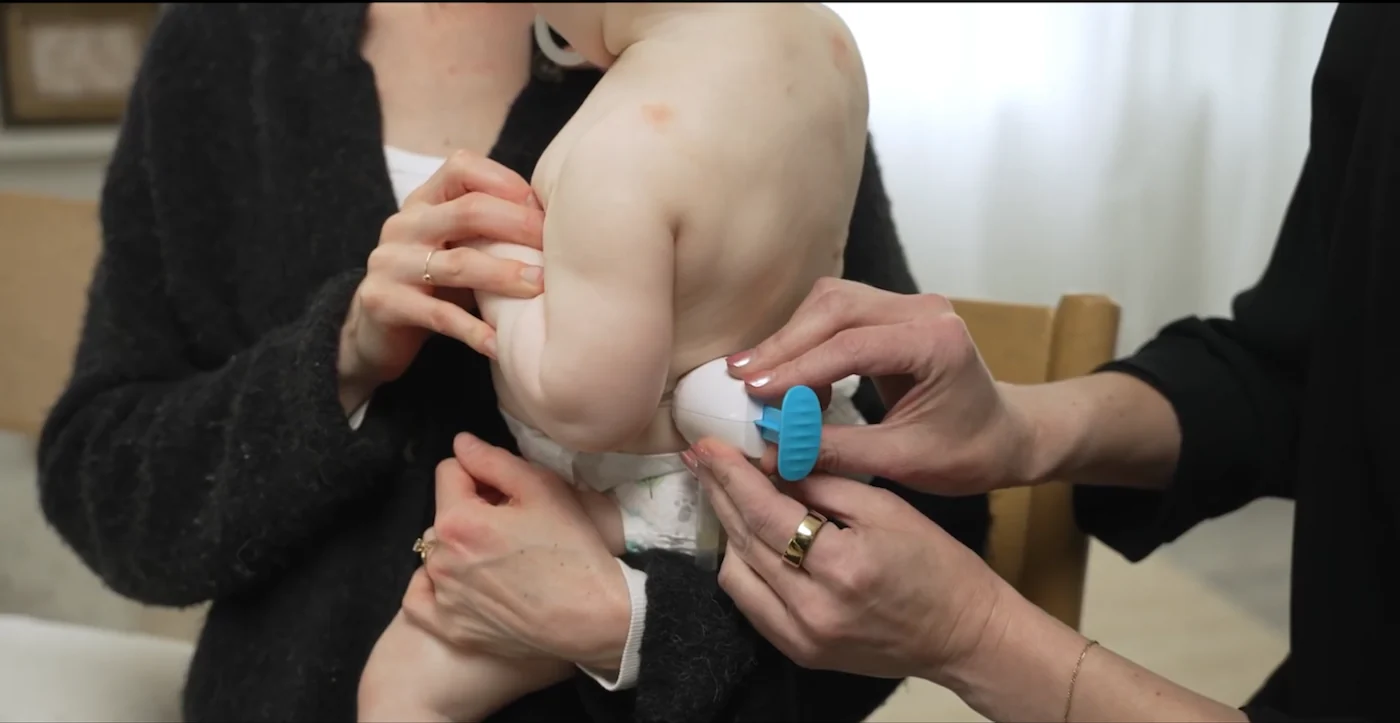 A TAP capillary collector on a newborn's upper arm during a blood collection